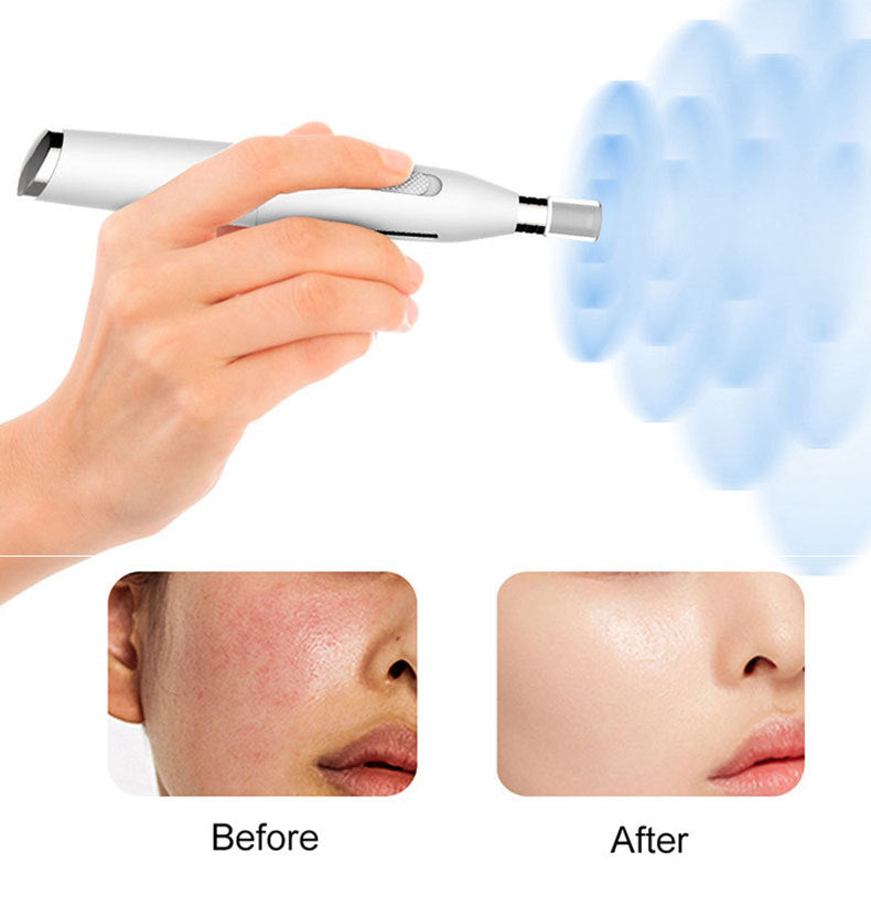 Microneedling Pen