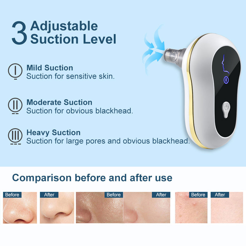 Electric Blackhead Remover Kit: Suction Facial Pore Cleanser & Acne Cleaner